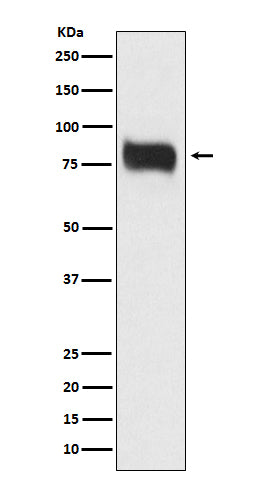 MBD1 (3J6) Rabbit Monoclonal Antibody