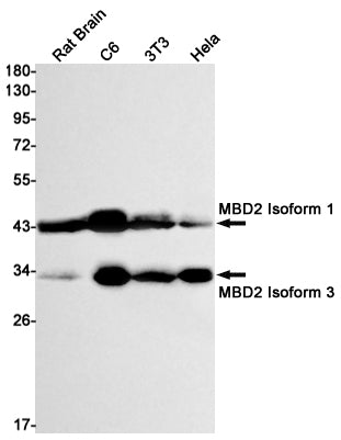 MBD2 (12B17) Rabbit Monoclonal Antibody