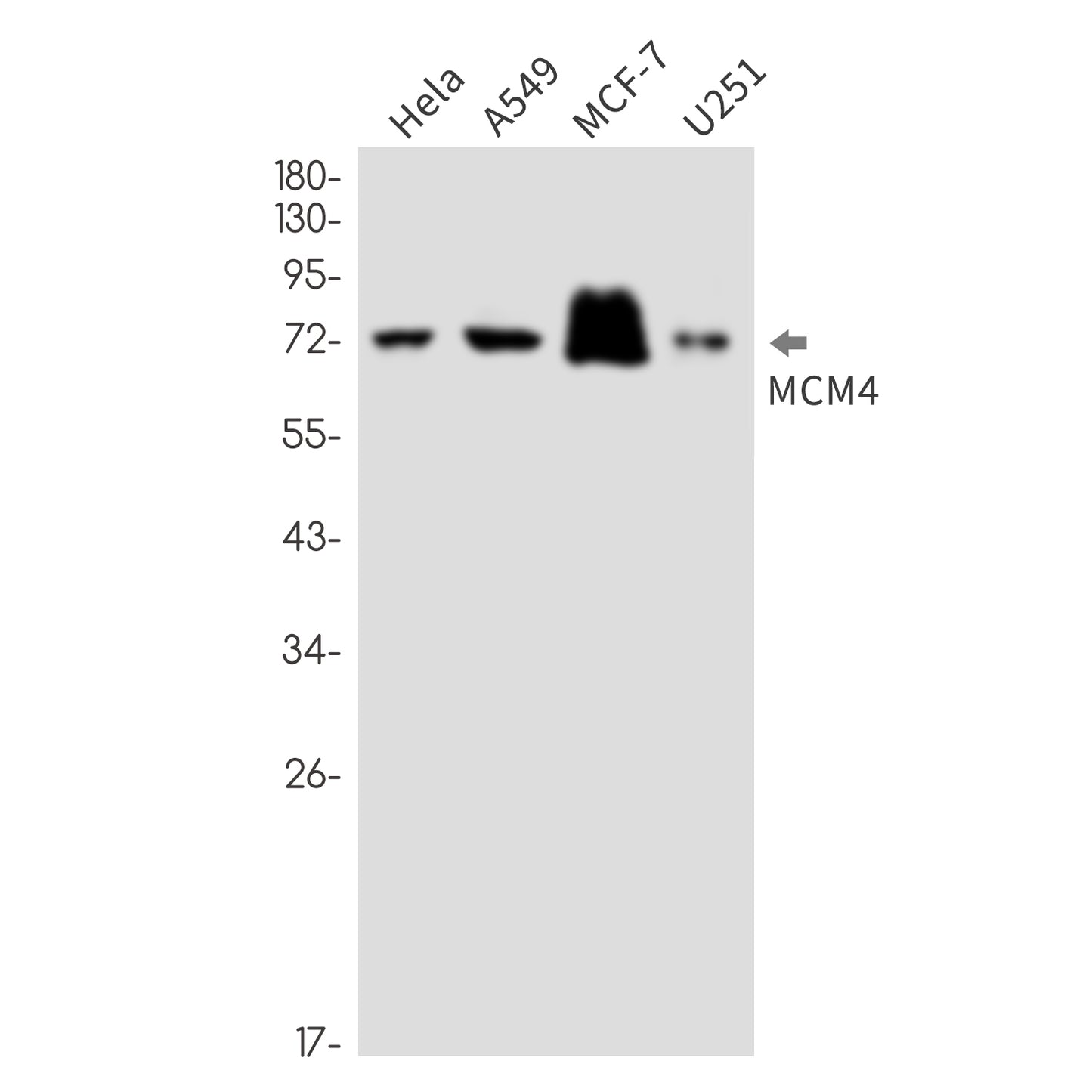 MCM4 (8D13) Rabbit Monoclonal Antibody