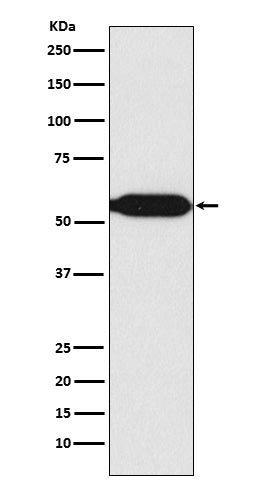 MEF2C (17M6) Rabbit Monoclonal Antibody