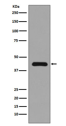 MEK1 (12Q9) Rabbit Monoclonal Antibody