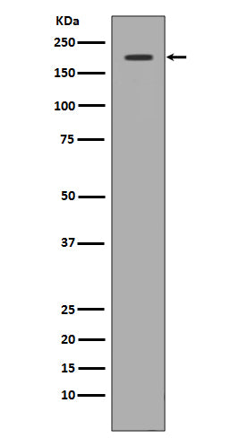 Met (c-Met) (12F15) Rabbit Monoclonal Antibody