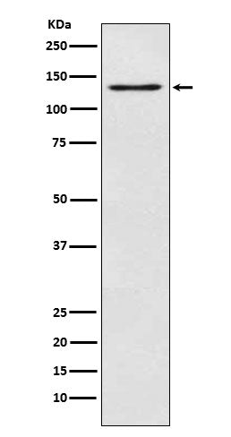 MGEA5 (10M9) Rabbit Monoclonal Antibody