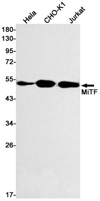 MiTF (3C16) Rabbit Monoclonal Antibody