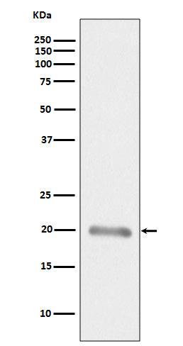 MLANA (10J15) Rabbit Monoclonal Antibody
