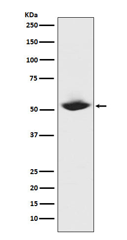 MMP1 (7R3) Rabbit Monoclonal Antibody