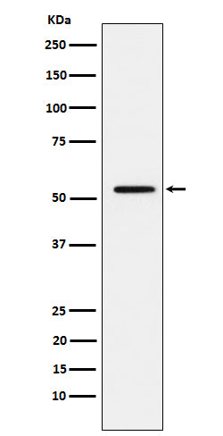 MMP1 (7T4) Rabbit Monoclonal Antibody