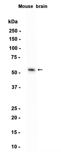 MMP17 (19A10) Rabbit Monoclonal Antibody