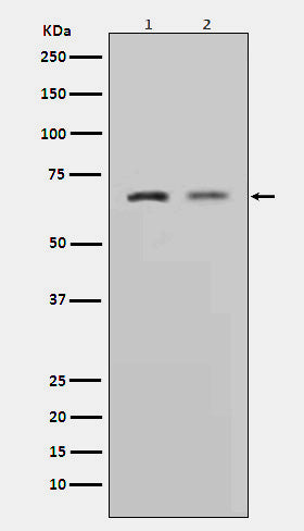 MMP2 (13Q13) Rabbit Monoclonal Antibody