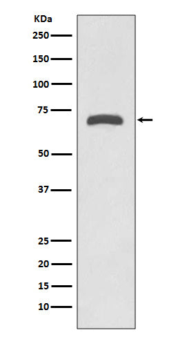 MMP8 (4B14) Rabbit Monoclonal Antibody