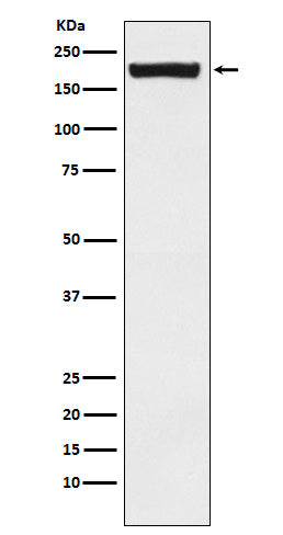 MRC2/ENDO180 (10A4) Rabbit Monoclonal Antibody
