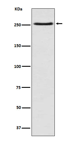 mTOR (1L6) Rabbit Monoclonal Antibody