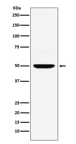 MUM1 (9F19) Rabbit Monoclonal Antibody