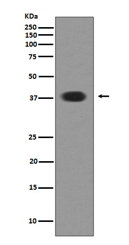 Musashi 1 (19M18) Rabbit Monoclonal Antibody