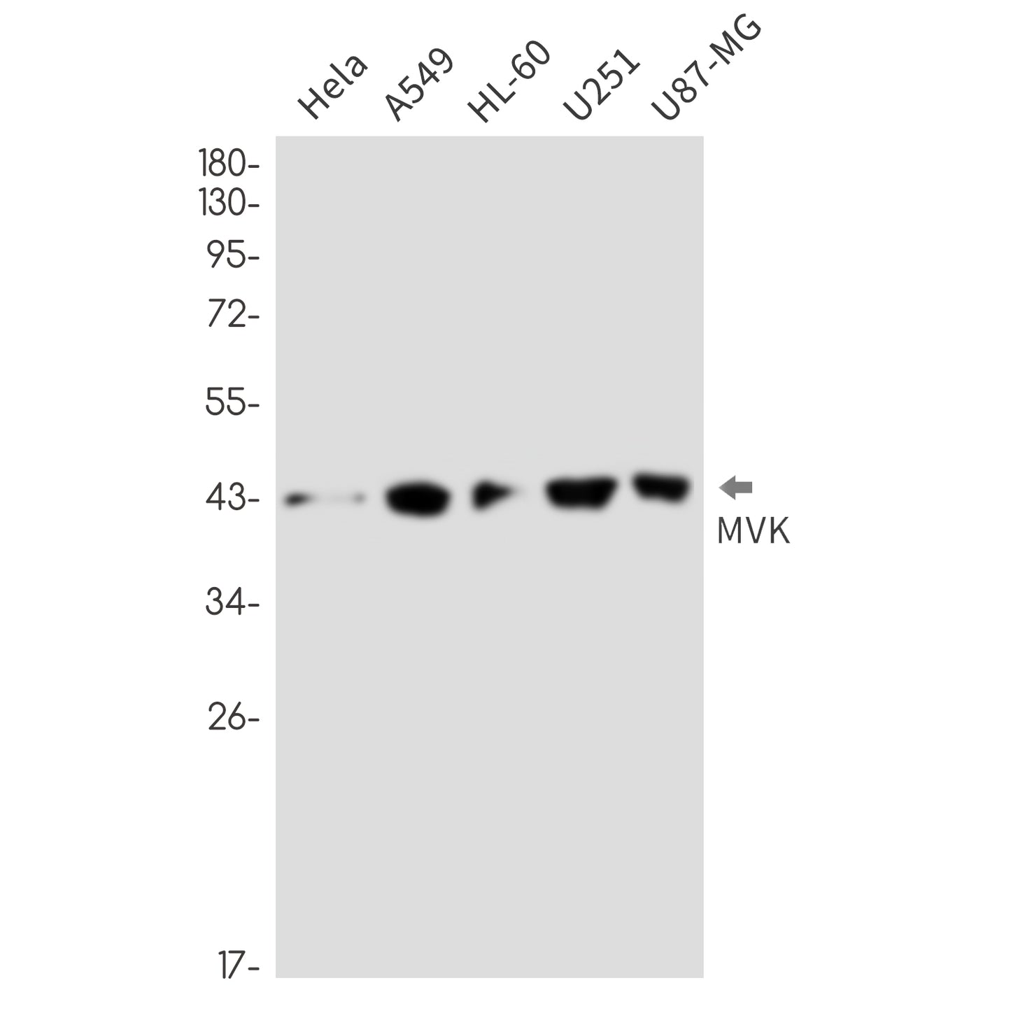 MVK (17J12) Rabbit Monoclonal Antibody