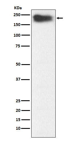 MYH7B (16E9) Rabbit Monoclonal Antibody