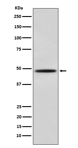MyoD (5R13) Rabbit Monoclonal Antibody