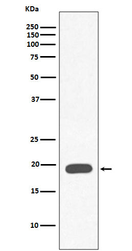 Myoglobin (17N17) Rabbit Monoclonal Antibody