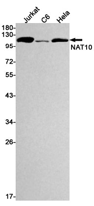 NAT10 (7O15) Rabbit Monoclonal Antibody