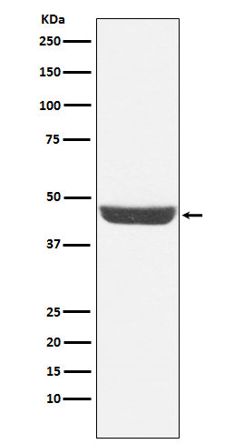 NDRG1 (3L1) Rabbit Monoclonal Antibody