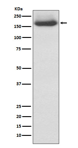 NEFM (5A2) Rabbit Monoclonal Antibody