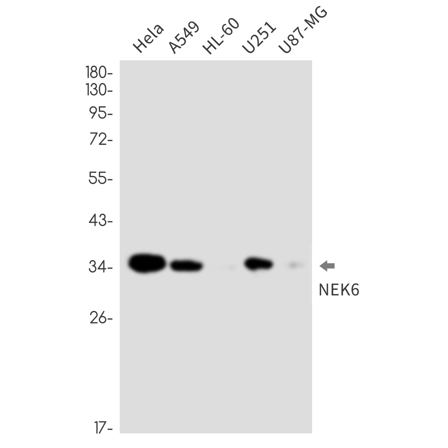 NEK6 (6Q4) Rabbit Monoclonal Antibody
