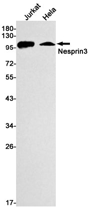 Nesprin3 (17X13) Rabbit Monoclonal Antibody