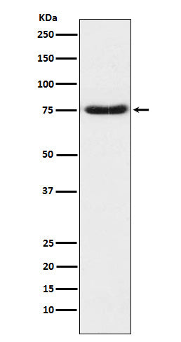 Netrin 1 (8Q2) Rabbit Monoclonal Antibody