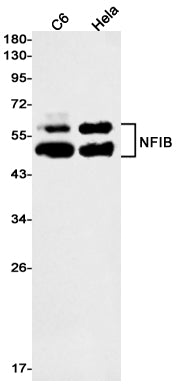 NFIB / NF1B2 (7L18) Rabbit Monoclonal Antibody