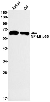 NF-KB p65 (6L9) Rabbit Monoclonal Antibody
