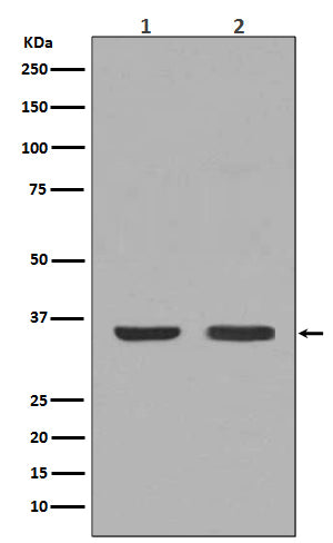 NGF (12T9) Rabbit Monoclonal Antibody