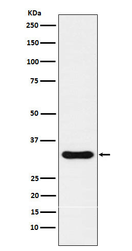 NKX3.1 (9R11) Rabbit Monoclonal Antibody