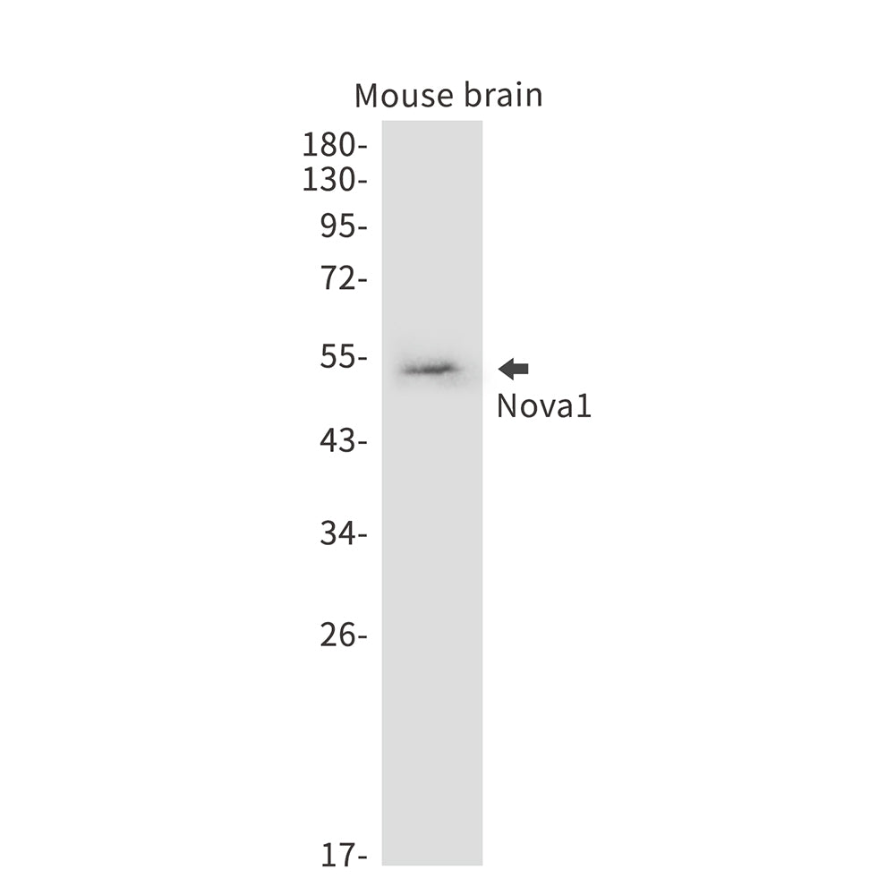 Nova1 (15E17) Rabbit Monoclonal Antibody