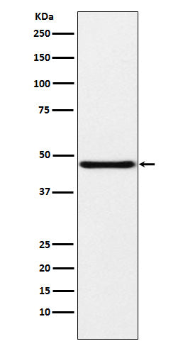 NPHS2 (6L18) Rabbit Monoclonal Antibody