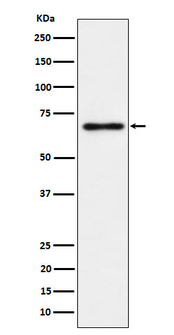 NR2C2 / TR4 (9S17) Rabbit Monoclonal Antibody