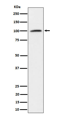 Nucleolin (7Z11) Rabbit Monoclonal Antibody