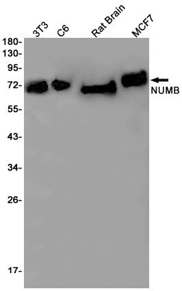 NUMB (16Y18) Rabbit Monoclonal Antibody