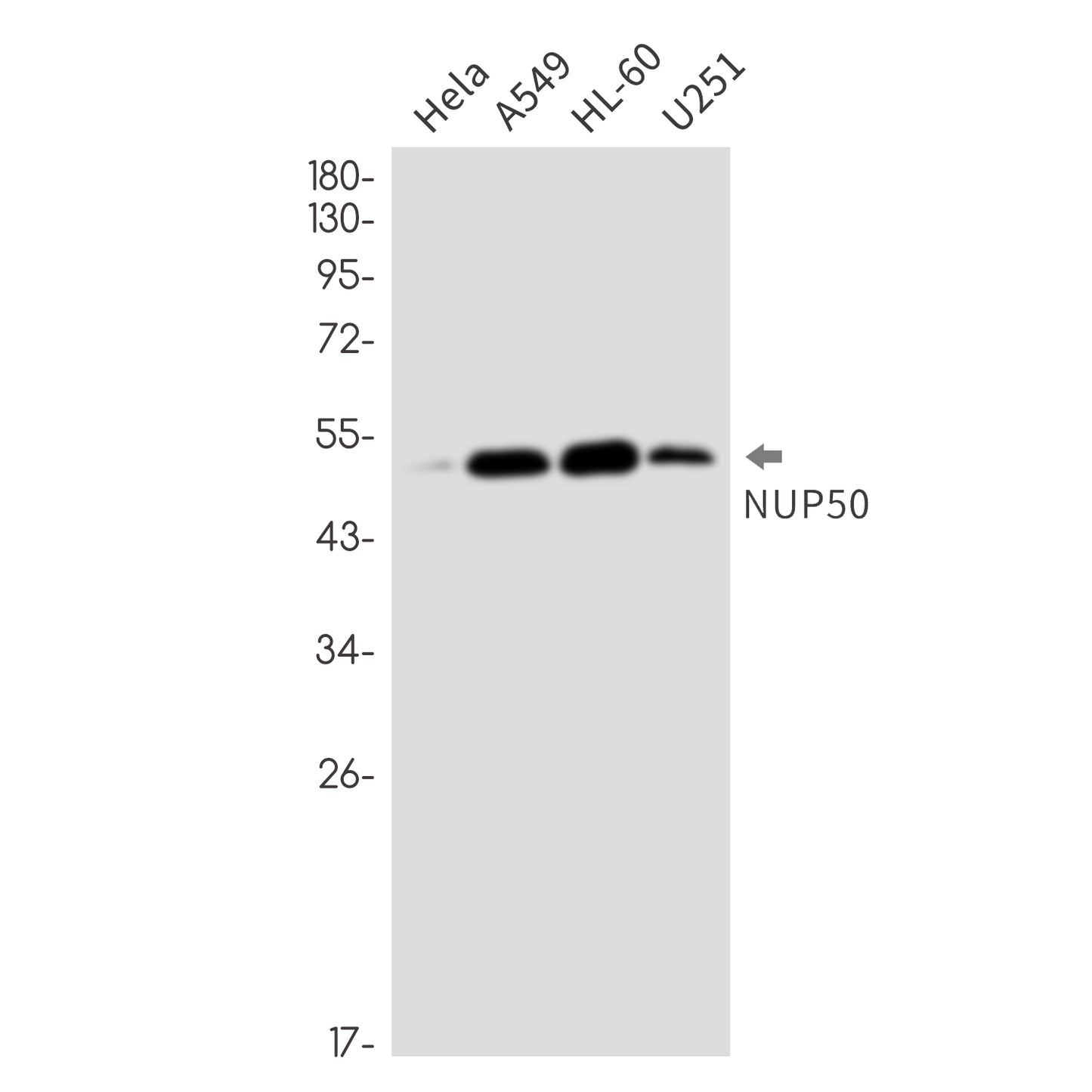 NUP50 (13J18) Rabbit Monoclonal Antibody