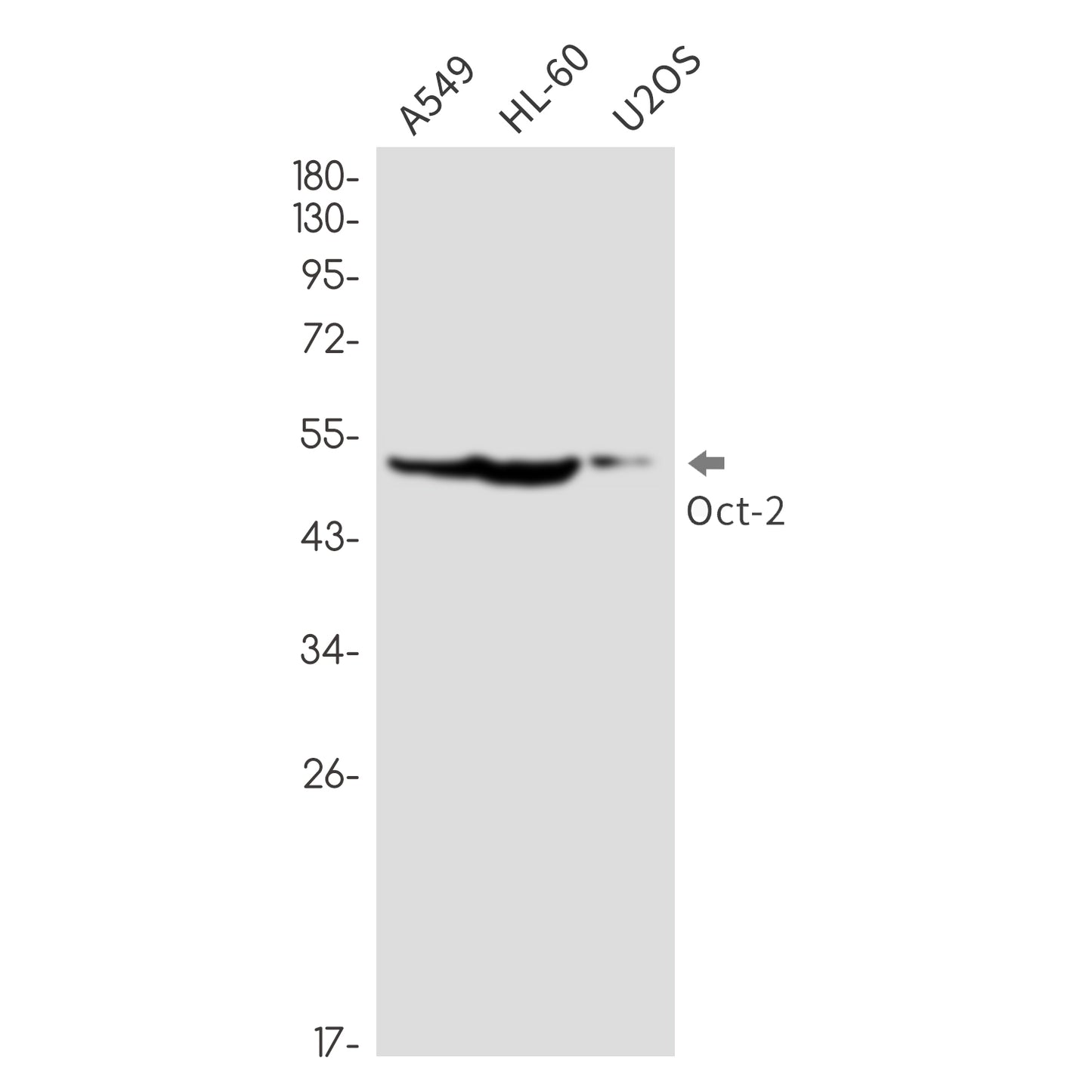 Oct-2 (14K1) Rabbit Monoclonal Antibody