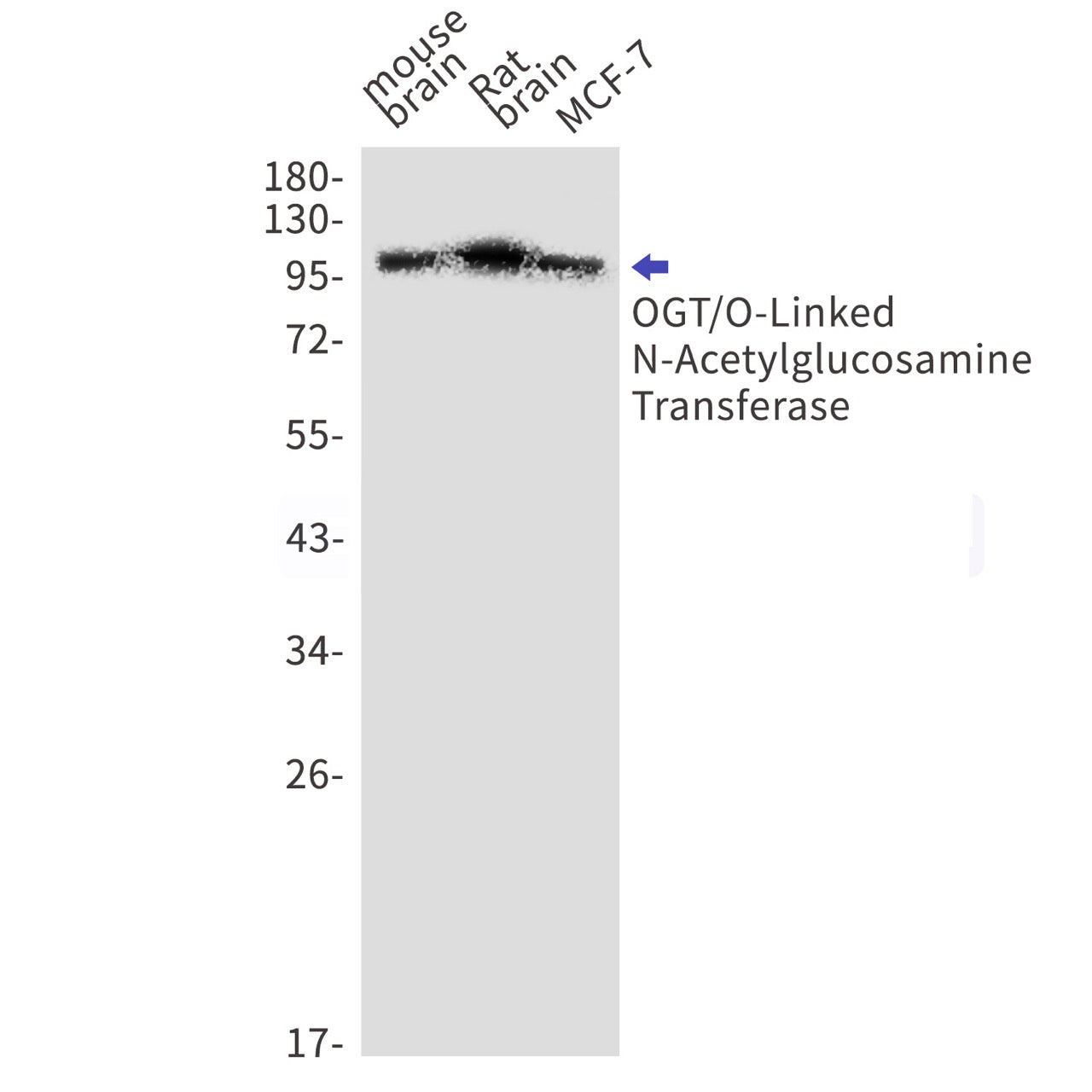 OGT (19A13) Rabbit Monoclonal Antibody