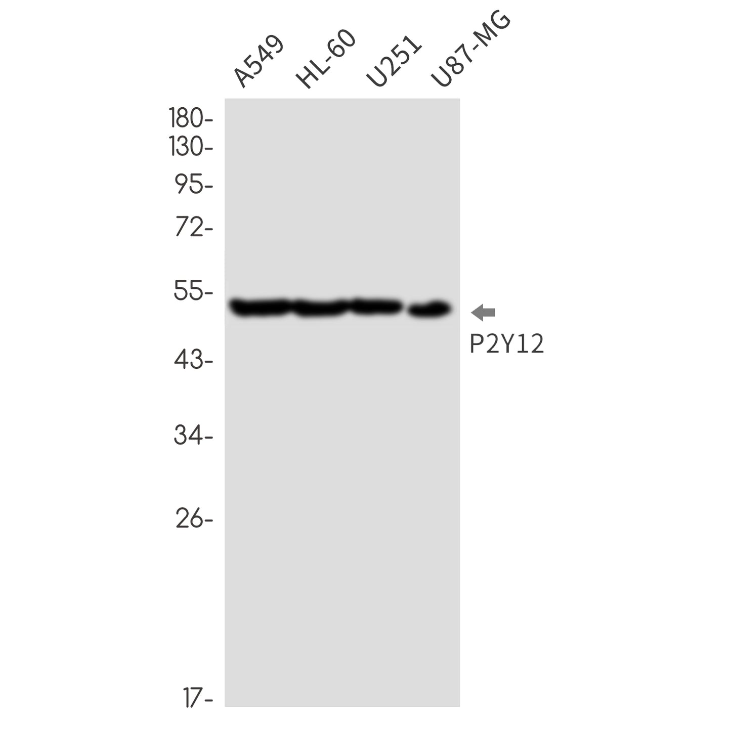P2Y12 (3U6) Rabbit Monoclonal Antibody