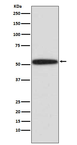 p53 (15W6) Rabbit Monoclonal Antibody