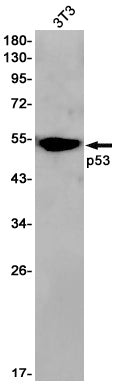 p53 (9D15) Rabbit Monoclonal Antibody