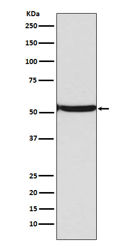 p53 (acetyl K382) (17F2) Rabbit Monoclonal Antibody