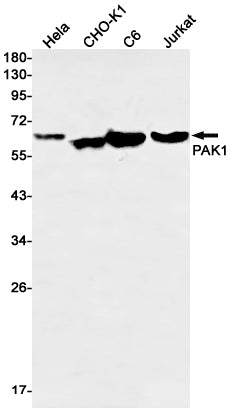 PAK1 (11Q14) Rabbit Monoclonal Antibody