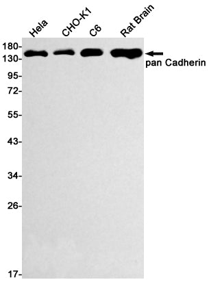 pan Cadherin (16E7) Rabbit Monoclonal Antibody