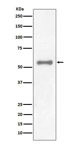 PAX7 (17K19) Rabbit Monoclonal Antibody
