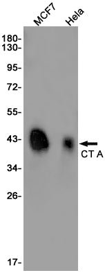 PCYT1A (4Z18) Rabbit Monoclonal Antibody