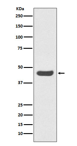 PD-L1 (CD274) (5R18) Rabbit Monoclonal Antibody