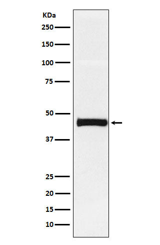 Pentraxin 3 (14E14) Rabbit Monoclonal Antibody